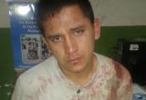 Su víctima quedó con la cabeza rota. Le hicieron 52 puntos para cerrar la gran herida. Foto: Trujillo en Línea