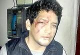 Fue golpeado por taxistas que lo descubrieron robando. Foto: Trujillo en Línea