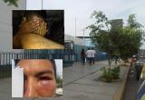 Así quedó el ojo del agraviado. Foto: Trujillo en Línea