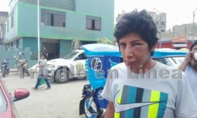 Su rostro quedó totalmente desfigurado. Foto: Trujillo en Línea