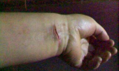 Mujer exhibió las pruebas del maltrato que habría sufrido por parte del sujeto detenido. (Foto: Difusión)