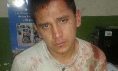 Su víctima quedó con la cabeza rota. Le hicieron 52 puntos para cerrar la gran herida. Foto: Trujillo en Línea