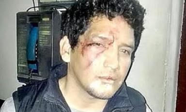Fue golpeado por taxistas que lo descubrieron robando. Foto: Trujillo en Línea
