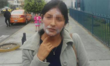 Joven teme que quemaduras dejen cicatrices. Foto: Trujillo en Línea