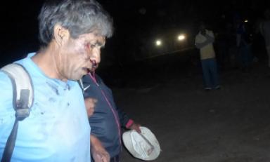 Gilberto de la Cruz, trabajador herido durante protestas en Virú. (Foto cortesía)