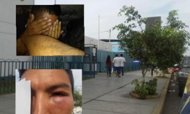 Así quedó el ojo del agraviado. Foto: Trujillo en Línea