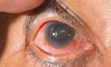 Foto: cortesía Minsa