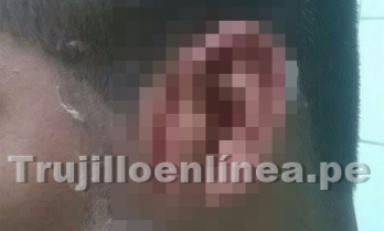 Joven tiene un gran corte al costado de la oreja. Foto: Trujillo en Línea