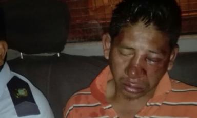 Sujeto fue golpeado varias veces antes de ser entregado. Foto: Trujillo en Línea