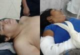 Heridos permanecen recuperándose en hospital Regional. Foto: Trujillo en Línea