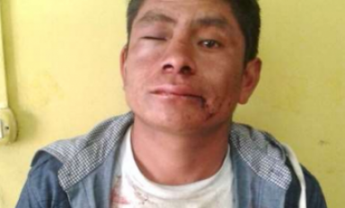 La madre de la víctima acusó a su hermano de haber ultrajado a esta. (Foto: Difusión)