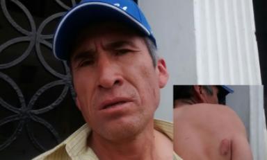 Hombres fue mordido y arañado. Foto: Trujillo en Línea